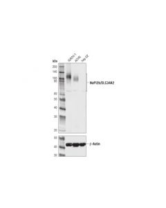 Cell Signaling Napi2b/Slc34a2 (D6w2g) Rabbit mAb (Bsa And Azide Free)