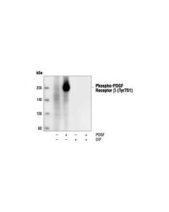 Cell Signaling Phospho-Pdgf Receptor Beta (Tyr751) (88h8) Mouse mAb