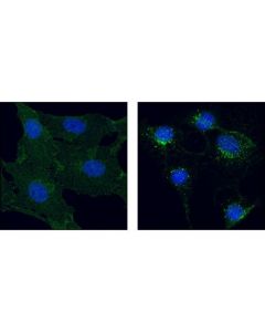 Cell Signaling Pdgf Receptor Beta (28e1) Rabbit mAb