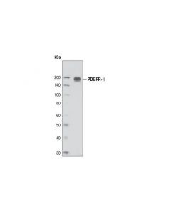 Cell Signaling Pdgf Receptor Beta (2b3) Mouse mAb