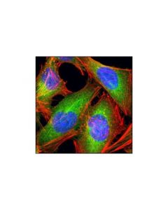 Cell Signaling Fatty Acid Synthase (C20g5) Rabbit mAb