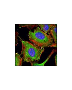 Cell Signaling Pkm1/2 (C103a3) Rabbit mAb