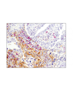 Cell Signaling Signalstain Boost Ihc Detection Reagent (Ap, Mouse)
