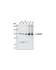 Cell Signaling Alpha-E-Catenin (23b2) Rabbit mAb