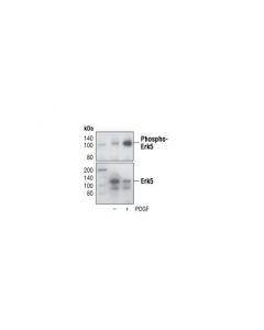 Cell Signaling Phospho-Erk5 (Thr218/Tyr220) Antibody