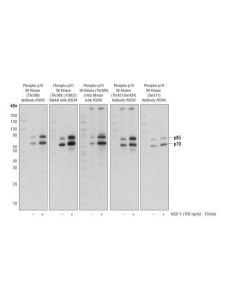 Cell Signaling P70 S6 Kinase Mcf7 Control Cell Extracts