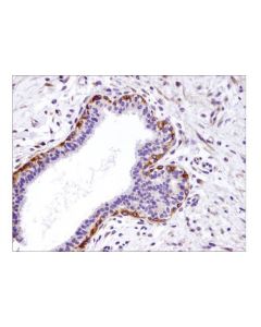 Cell Signaling Integrin Beta1 (D6s1w) Rabbit mAb