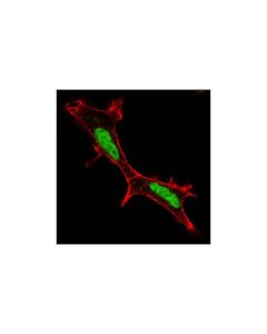 Cell Signaling Brg1 (A52) Antibody