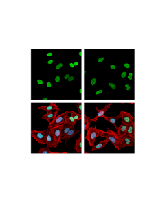 Cell Signaling Rpa32/Rpa2 (E8x5p) Xp Rabbit mAb