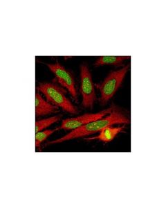 Cell Signaling Rcc1 Antibody