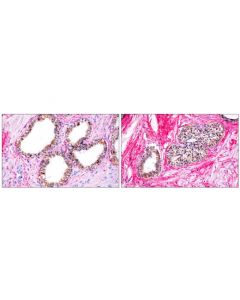 Cell Signaling Signalstain Ihc Dual Staining Kit (Ap, Rabbit, Red / Hrp, Mouse, Brown)