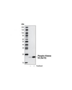 Cell Signaling Phospho-Histone H3 (Ser10) (D2c8) Xp Rabbit mAb (Biotinylated)