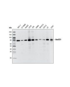 Cell Signaling Acecs1 (D19c6) Rabbit mAb