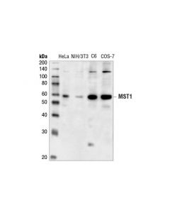 Cell Signaling Mst1 Antibody