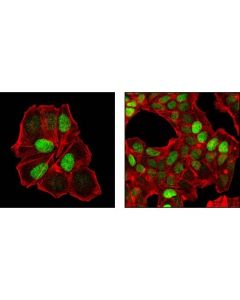 Cell Signaling P27 Kip1 (Sx53g8.5) Mouse mAb