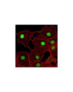 Cell Signaling Mcm7 (D10a11) Xp Rabbit mAb