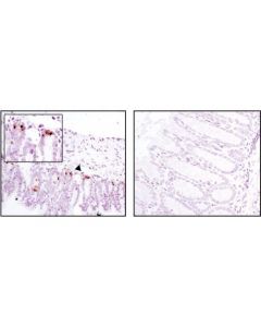 Cell Signaling Mmp-7 (D4h5) Xp Rabbit mAb