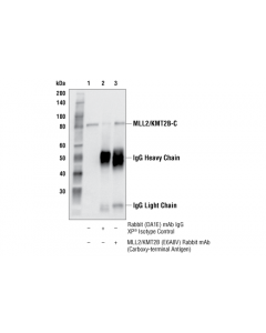 Cell Signaling Mll2/Kmt2b (E6a8v) Rabbit mAb (Carboxy-Terminal Antigen)