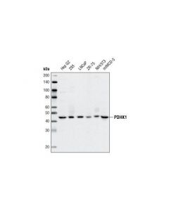 Cell Signaling Pdhk1 (C47h1) Rabbit mAb