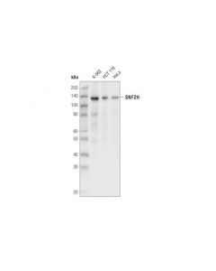 Cell Signaling Snf2h (D4w6n) Rabbit mAb