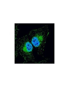 Cell Signaling Appl1 (D83h4) Xp Rabbit mAb