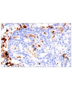 Cell Signaling Fibrinogen Gamma Chain (E1u3z) Xp® Rabbit mAb (Bsa And Azide Free)