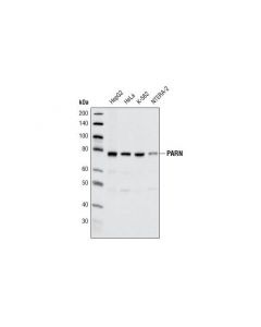 Cell Signaling Parn (P620) Antibody