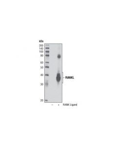 Cell Signaling Rank Ligand (R2) Antibody