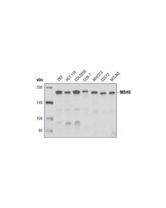 Cell Signaling Msh6 (P150) Antibody
