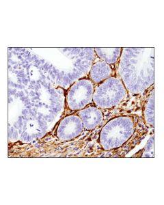 Cell Signaling Galectin-1/Lgals1 (8a12) Mouse mAb