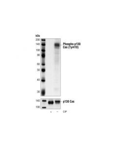 Cell Signaling Phospho-P130 Cas (Tyr410) Antibody