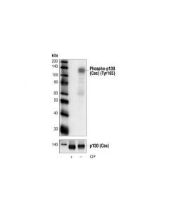Cell Signaling Phospho-P130 Cas (Tyr165) Antibody