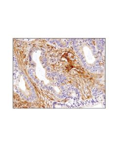Cell Signaling Talin-1 (C45f1) Rabbit mAb