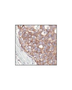 Cell Signaling Pan-Cadherin Antibody