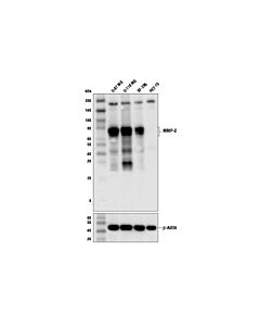 Cell Signaling MMP-2 (D4M2N) Rabbit mAb