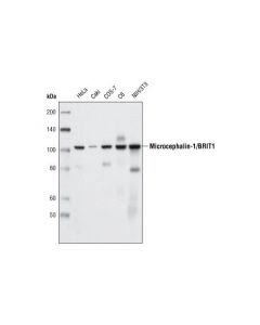 Cell Signaling Microcephalin-1/Brit1 (D38g5) Rabbit mAb