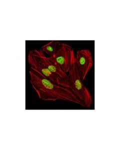 Cell Signaling Tif1beta Antibody
