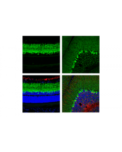 Cell Signaling Gad1 (D1f2m) Rabbit mAb