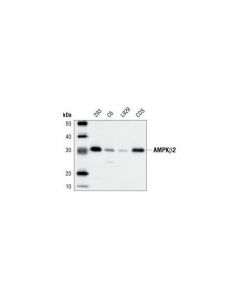 Cell Signaling Ampkbeta2 Antibody