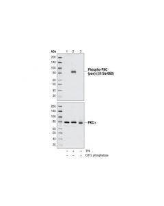 Cell Signaling Tpa (12-O-Tetradecanoylphorbol-13-Acetate)