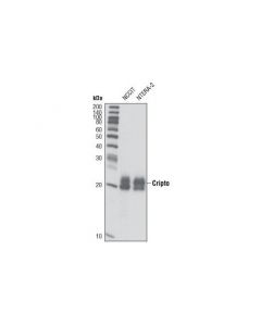 Cell Signaling Cripto (D81b12) Rabbit mAb (Human Specific)