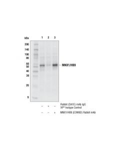 Cell Signaling Mnx1/Hb9 (E3w8d) Rabbit mAb