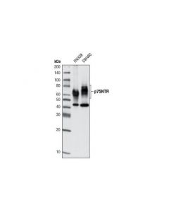 Cell Signaling P75ntr (D8a8) Rabbit mAb