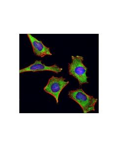 Cell Signaling Yb1 (D299) Antibody