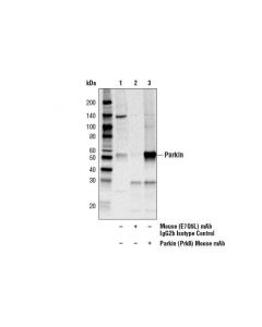 Cell Signaling Parkin (Prk8) Mouse mAb