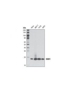 Cell Signaling Sod1 (71g8) Mouse mAb
