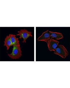 Cell Signaling Rab25 Antibody