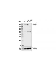 Cell Signaling Col2a1 (E8s2s) Rabbit mAb