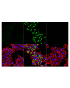 Cell Signaling Lc3b (E7x4s) Xp Rabbit mAb