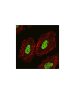 Cell Signaling Skp2 Antibody